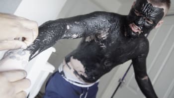 VIDEO: Youtubeři si pokryli slupovací maskou celé tělo, brzy ale litovali! Bolestivější video jste letos neviděli