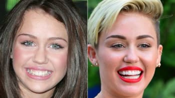 To je ale změna! 8 celebrit, kterým zubař zachránil kariéru