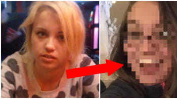 PŘÍBĚH: Holka ukázala svoji fotku 1000 dní poté, co přestala brát heroin. Změnila se k nepoznání