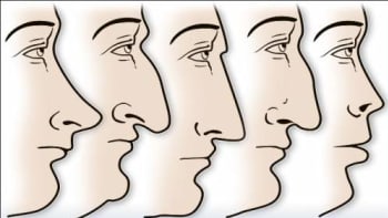 Co prozradí tvar nosu o vaší osobnosti? Budete se divit!