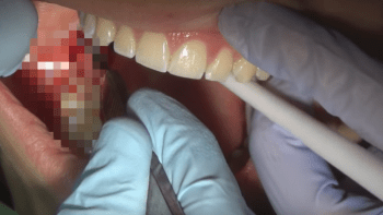 VIDEO: Tenhle hnus zubař vidí, když vám vyndává osmičky! Také on musí být fakt odvážný…
