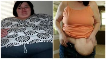 FOTO: Ženě se podařilo zhubnout neuvěřitelných 100 kilo! Jako metráček však byla šťastnější!
