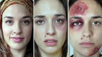 VIDEO: Oběť domácího násilí si každý den pořídila jednu fotografii. Neuvěříte, co je na té poslední