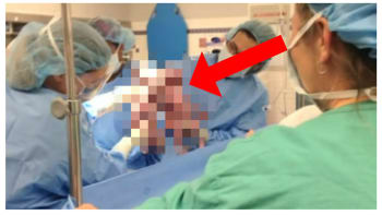 FOTO: Porodní sál ztichl, když matka přivedla na svět dvojčata! Obrovský šok vystřídal smích. Co se v porodnici stalo?