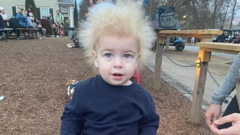GALERIE: Malý chlapec trpí syndromem neučesatelných vlasů. Stal se díky tomu hitem internetu!