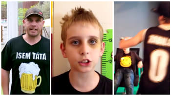 VIDEO: Otec Mishy promluvil o youtuberově děsivém monoklu! Může za něj facka od hatera?