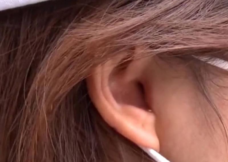 Žena šla na rhinoplastiku, ale uřízli jí kousek ucha 1
