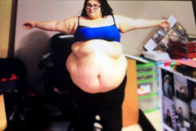 Žena zhubla neuvěřitelných 82 kilo 3