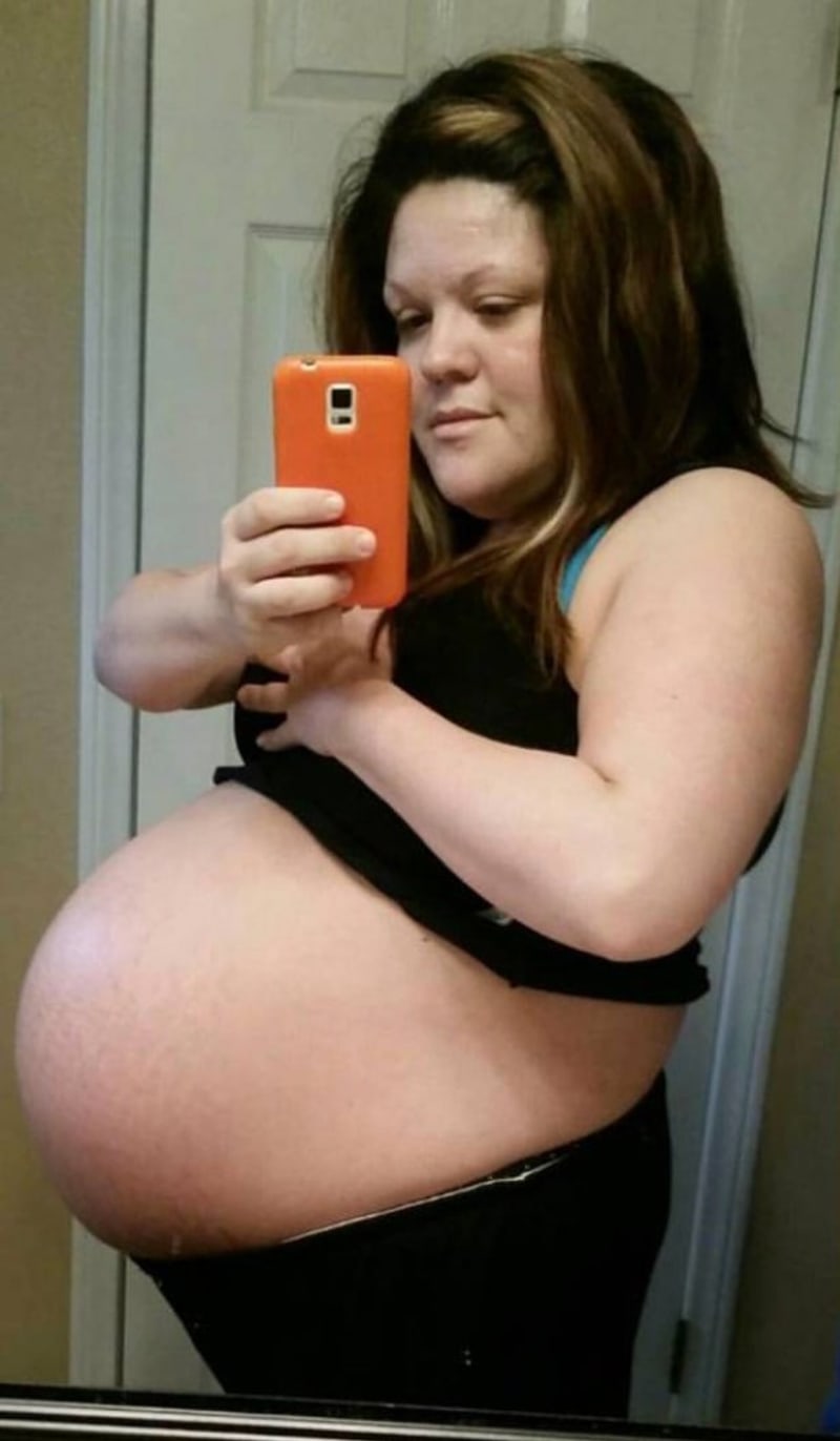 Žena výrazně zhubla po porodu dvojčat 8