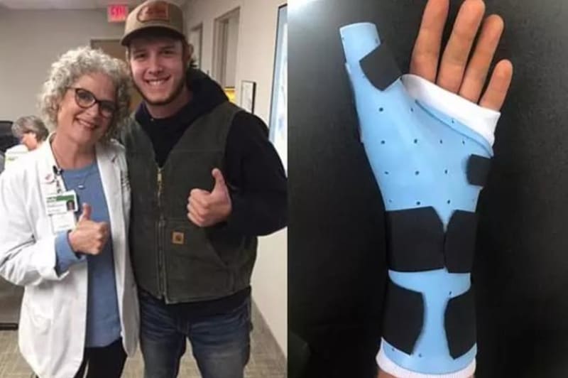 Lékaři nahradili chlápkovi palec u ruky 3