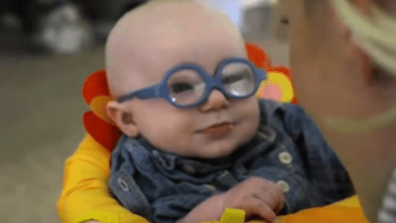 VIDEO: Malé miminko má vážnou zrakovou vadu. Podívejte se na jeho reakci, když mu nasadili speciální brýle