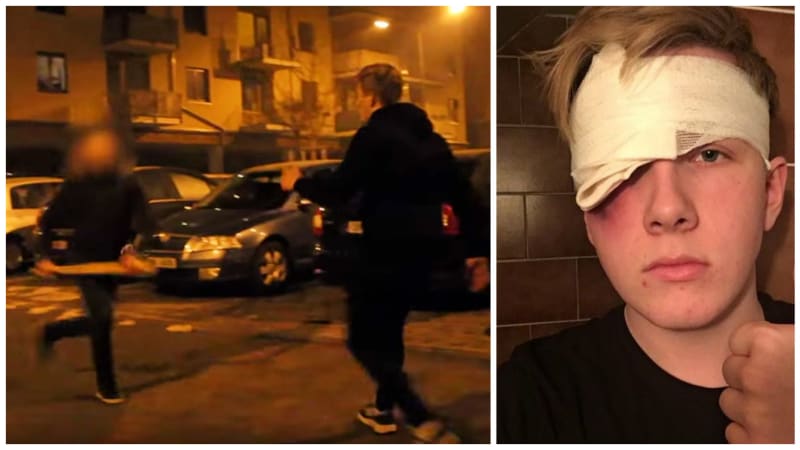 VIDEO: Šok! Youtubeři si chtěli vystřelit z prostitutky. Její pasák je ale brutálně zmlátil baseballovou pálkou! Co se jim stalo?