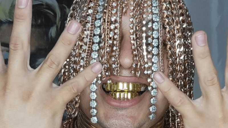 GALERIE: Slavný rapper si nechal do hlavy implantovat zlaté řetízky. Bude z toho nový trend?