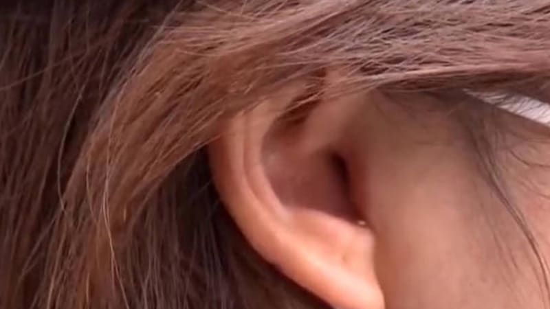 Žena zůstala v šoku, když se probudila po plastice nosu a zjistila, že jí chybí kousek ucha! Co se stalo?