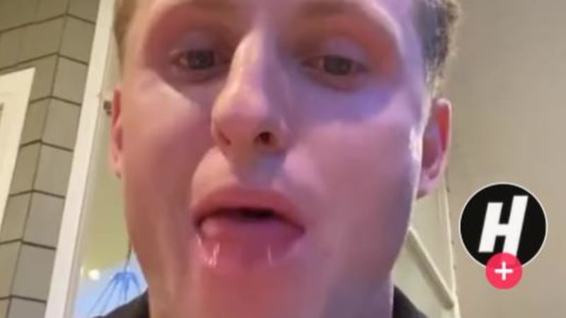 VIDEO: Muži šíleně otekl jazyk poté, co snědl hamburger! Jak se mu to proboha povedlo?