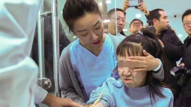 VIDEO: Dívka kvůli vzácné nemoci připomínala stařenu, pomohla jí až operace. Jak vypadá teď?