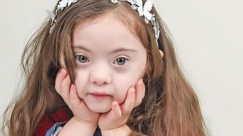 GALERIE: 4letá holčička s Downovým syndromem se foťáku nebojí! Tyhle momentky vás zahřejí u srdce