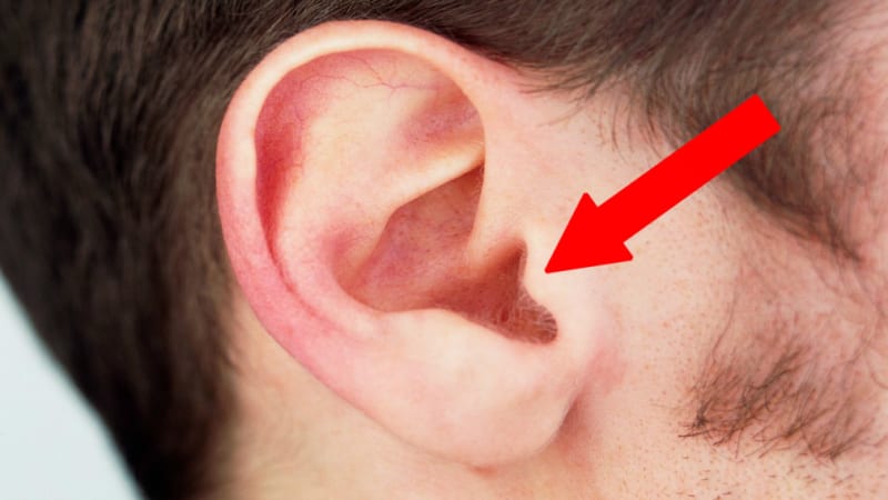 Odhaleno! Víte, co znamená tato věc na vašem uchu? Pokud ji máte, měli byste ihned zajít k doktorovi!