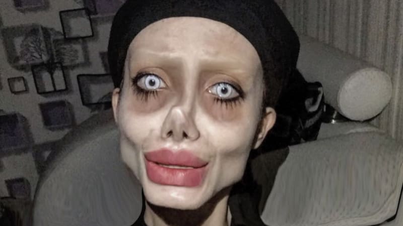 FOTO: Šílená žena, která si hrála na plastikovou Angelinu Jolie, sdílela děsivé fotky z postele. Vážně vypadá jako před smrtí?