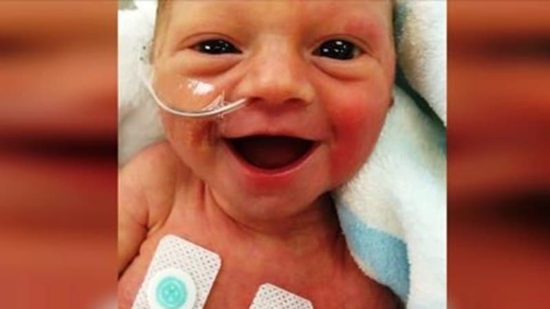 FOTO: Předčasně narozené miminko dalo strachujícím se rodičům naději díky tomuhle kouzelnému úsměvu!