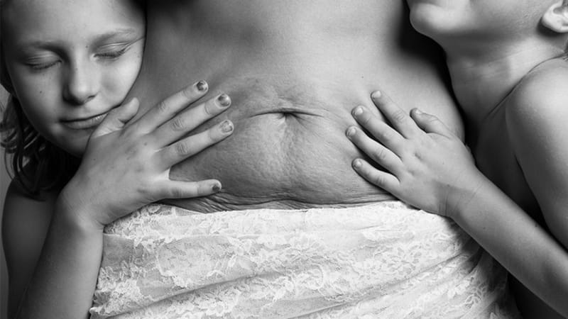GALERIE: Žena ukazuje odvážné fotografie toho, jak skutečně vypadá tělo po porodu. Tohle vám modelky z časopisů neukážou