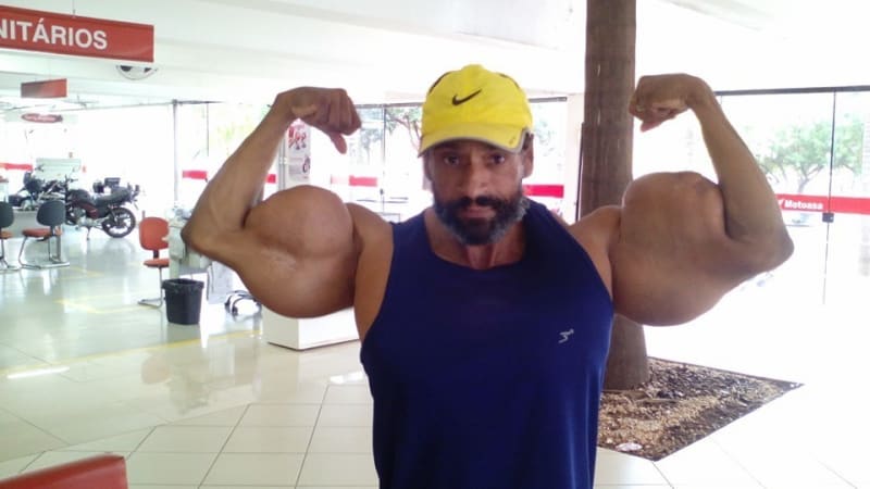 Ve věku 55 let zemřel brazilský Hulk. Kulturista byl závislý na vpichování oleje do svalů