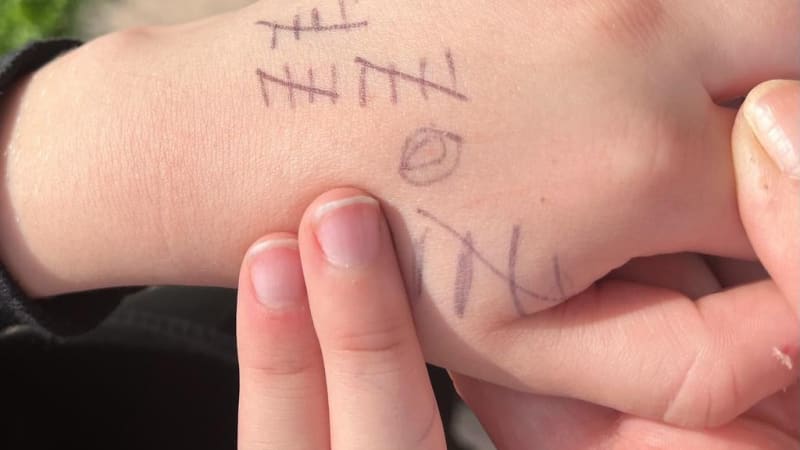 FOTO: Kluk si kreslil ve škole na ruku znaménka. Jejich pravý význam vás rozpláče