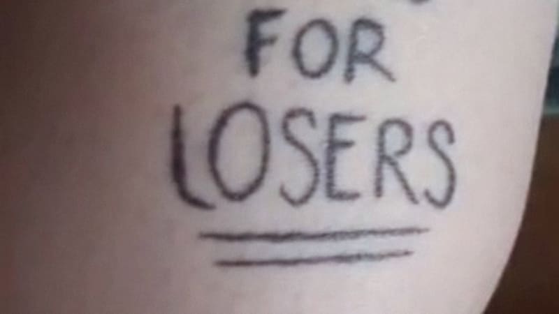 GALERIE: Lidé ukazují nejhloupější tetování, kterých teď hořce litují. Tyhle kérky byste rozhodně nechtěly
