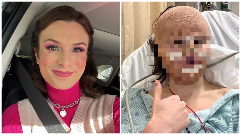 Trans tiktokerka podstoupila operaci obličeje, aby vypadala více žensky. Jak vypadá po vytouženém zákroku?