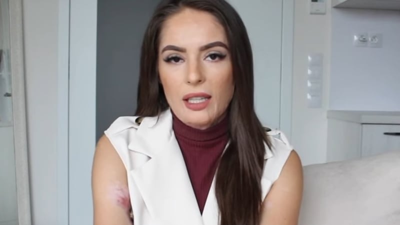 VIDEO: Popálená Týnuš Třešničková promluvila o léčbě a ukázala drsnou fotku z nemocnice. Co všechno musela vytrpět?