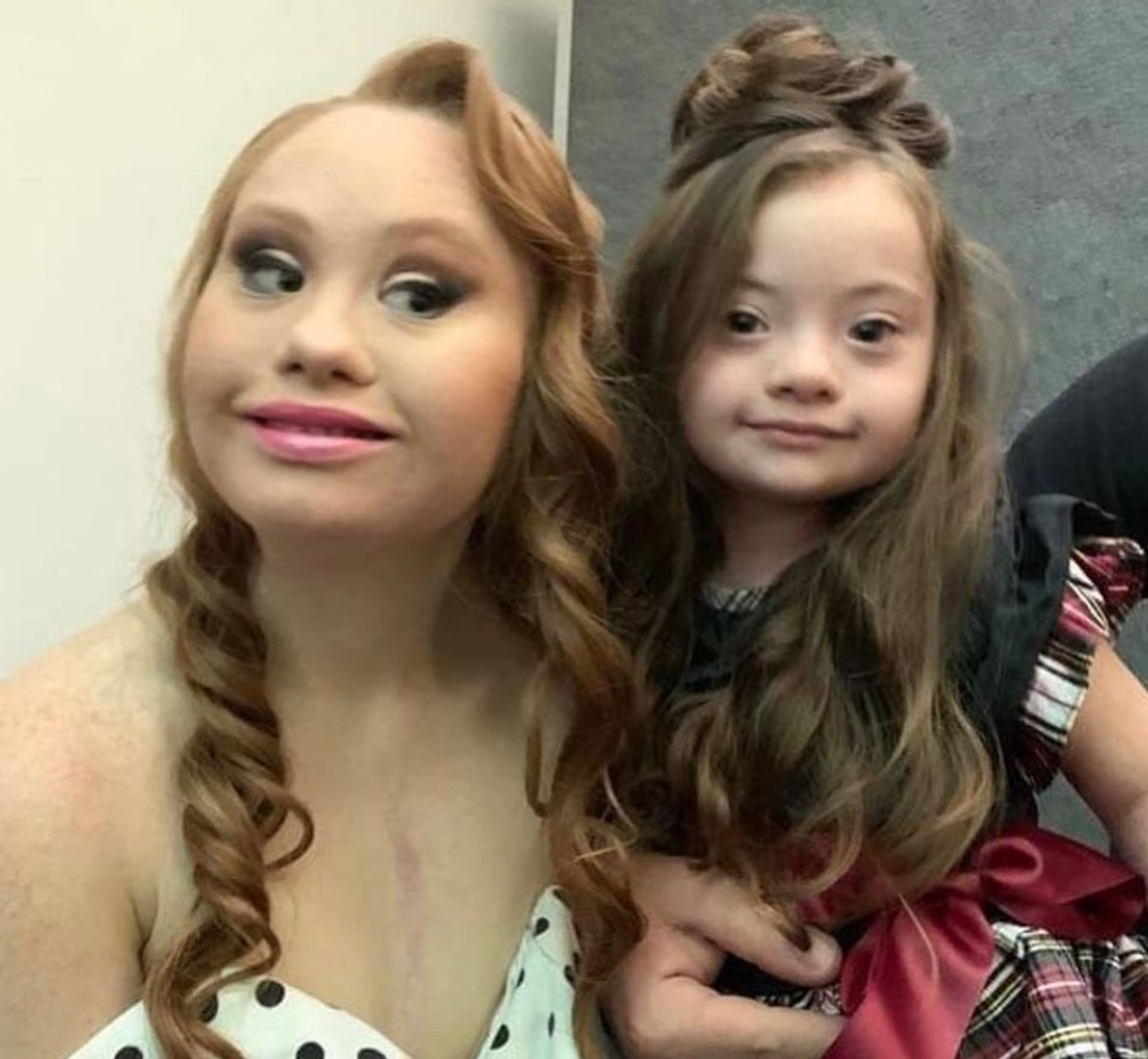 4letá dívka s Downovým syndromem pózuje jako modelka 5