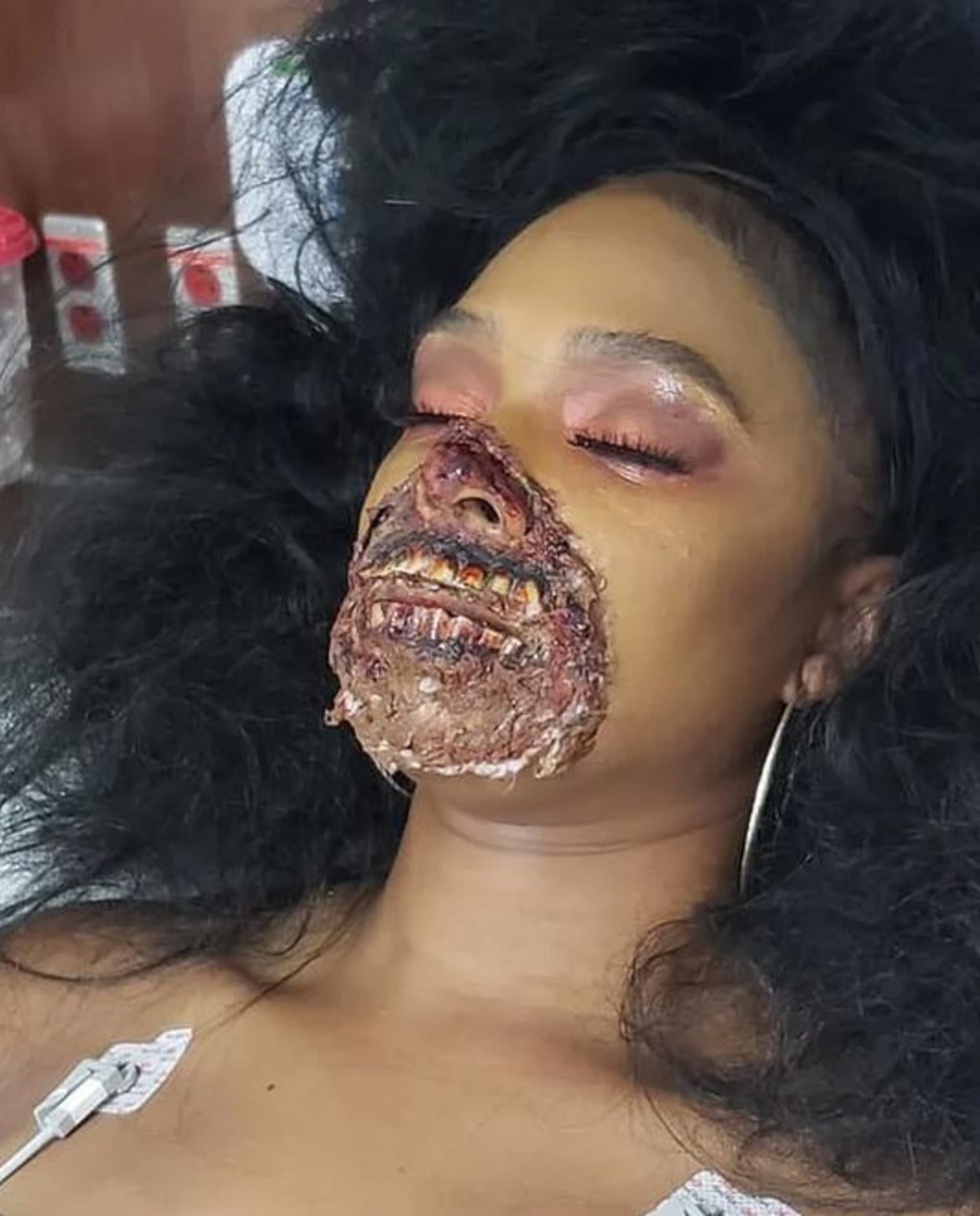 Žena se zombie make-upem děsila lékaře v nemocnici 1