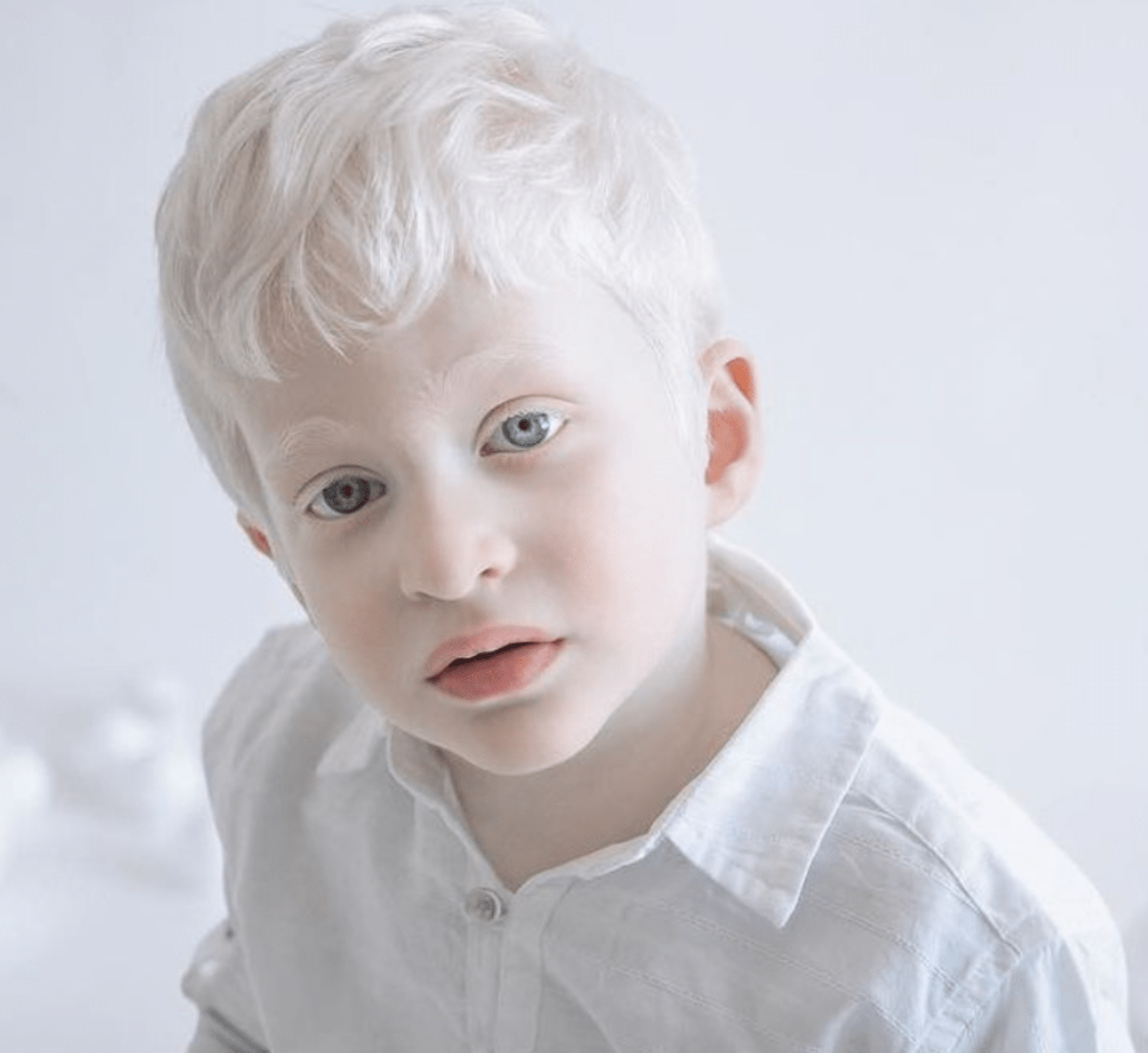 Krása lidí s albinismem 15