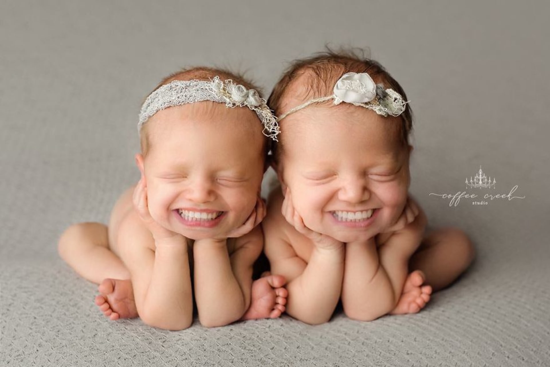 Fotky novorozenců se zuby děsí celý internet 7