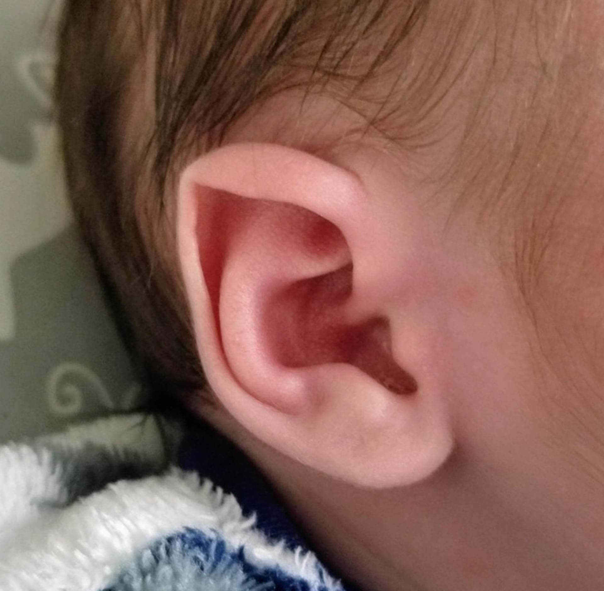 Dítě se narodilo s elfími uši.