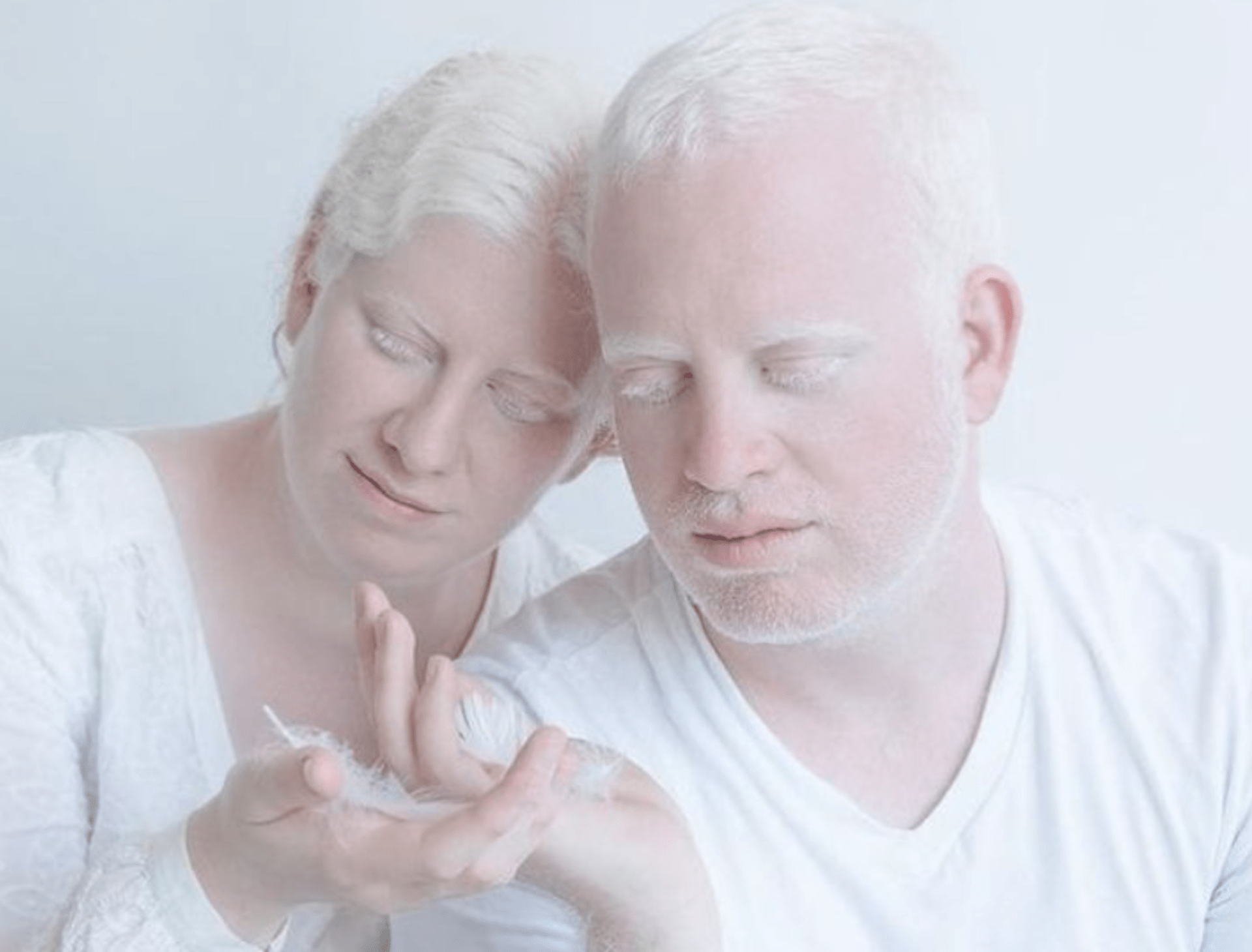 Krása lidí s albinismem 2