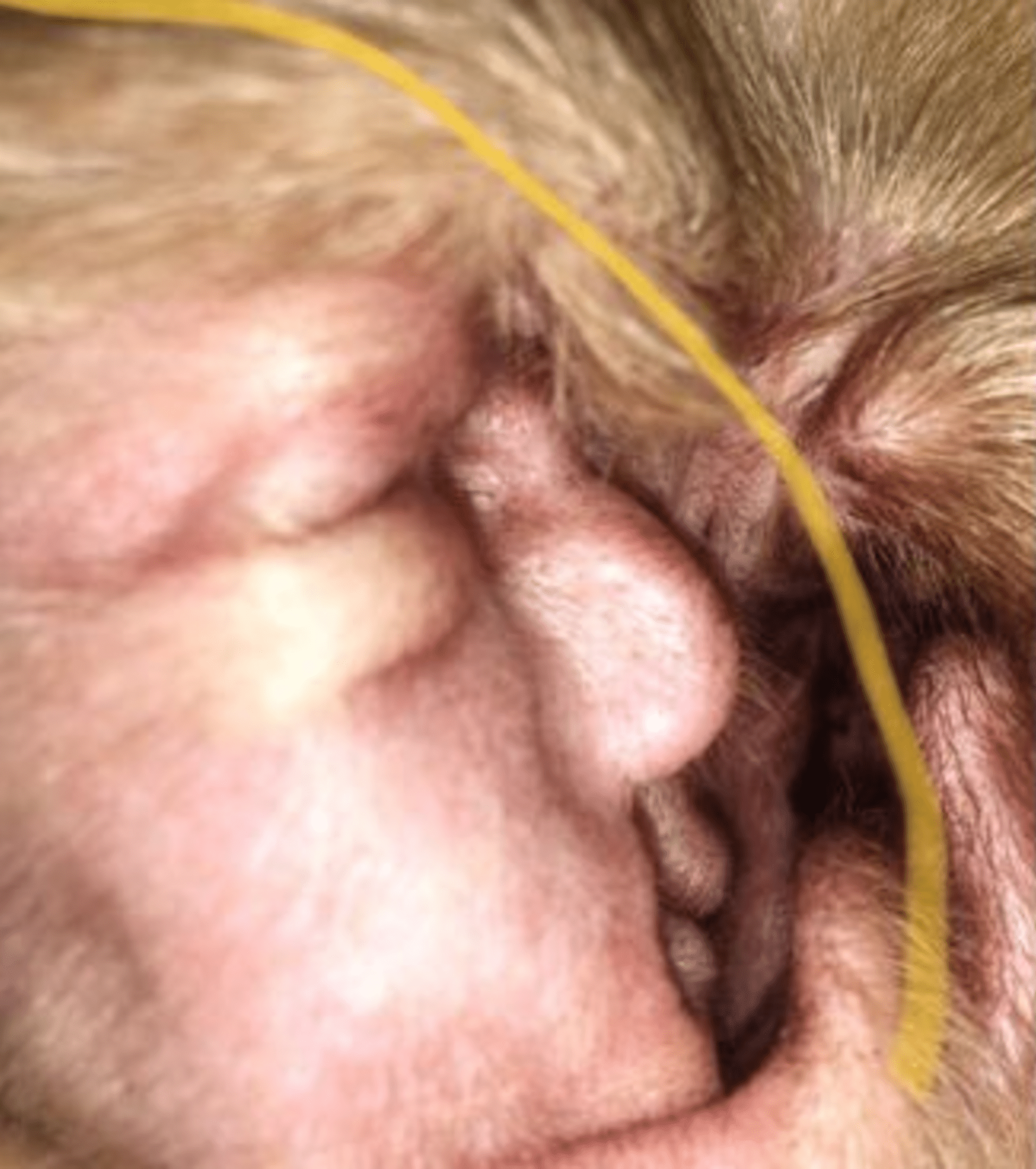 Cysta v uchu vypadá jako Donald Trump