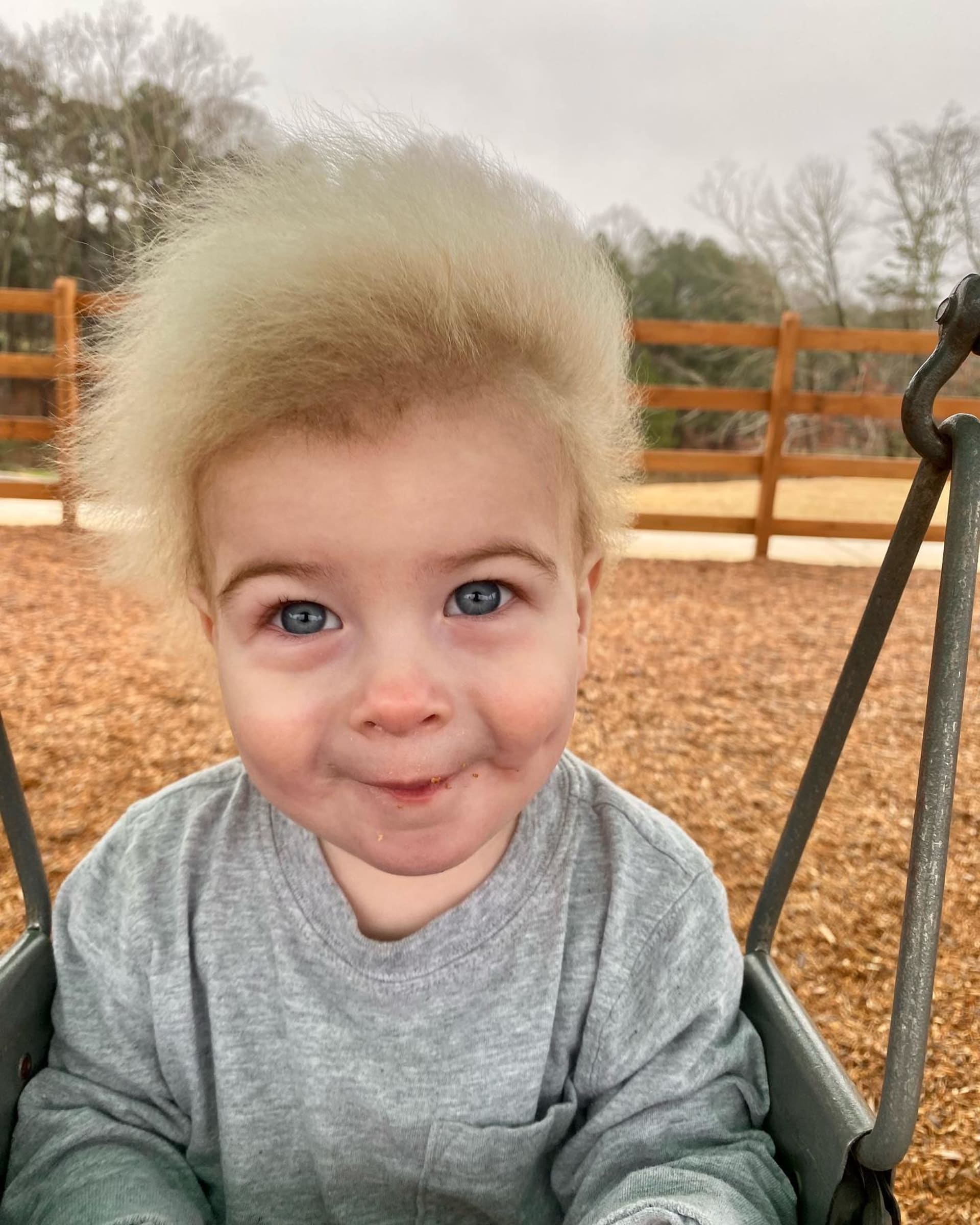 Desetiměsíční Locklan trpí syndromem neučesatelných vlasů.