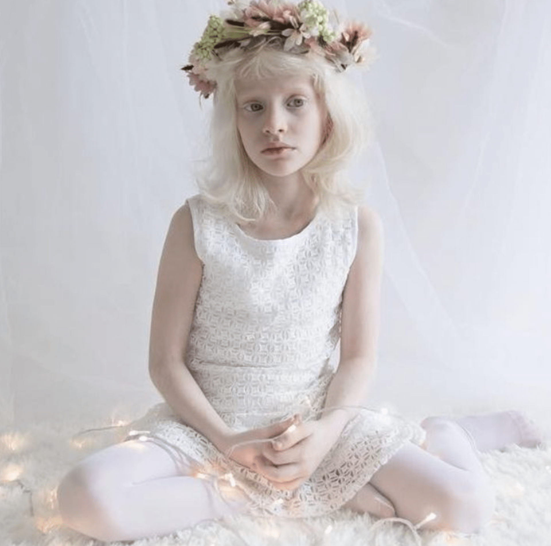 Krása lidí s albinismem 6