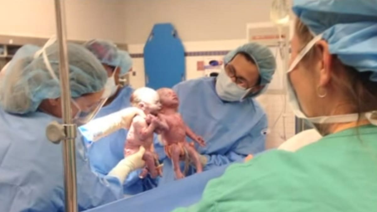 Miminka se držela při narození za ruku.