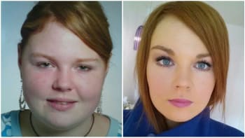 Neuvěřitelné proměny obličejů lidí po zhubnutí