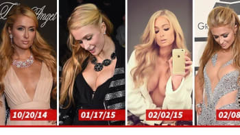Paris Hilton má nová prsa! Kde všude má implantáty?