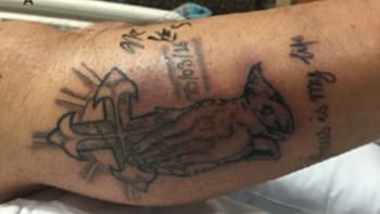 Muž zemřel kvůli novému tetování