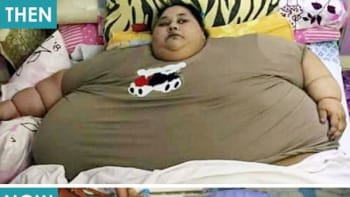 Nejtěžší žena světa zhubla polovinu své váhy 