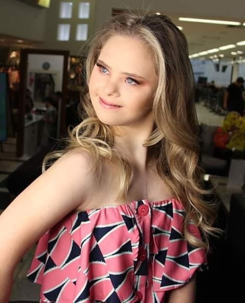 Modelka s Downovým syndromem je hvězdou Instagramu 1