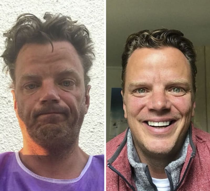 Levou fotografii muž pořídil po své hospitalizaci v nemocnici, na té pravé už se měsíce alkoholu nedotkl.