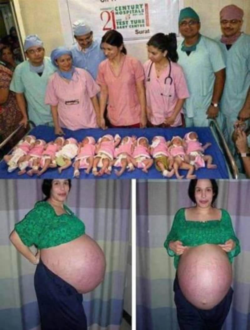 Žena porodila jedenáct dětí? - Obrázek 4