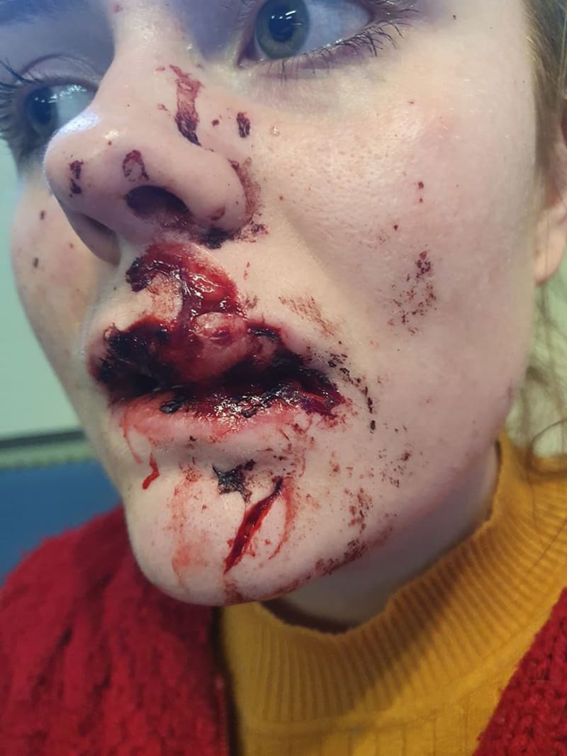 Útočníci napadli ženu a vyrazili jí zuby 2