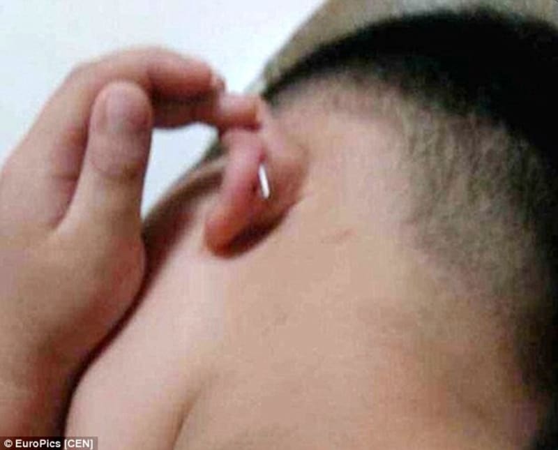 Chlapec se vrátil ze školky a měl v uchu sponku ze sešívačky - Obrázek 1