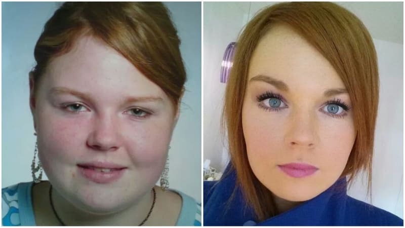 Neuvěřitelné proměny obličejů lidí po zhubnutí 1